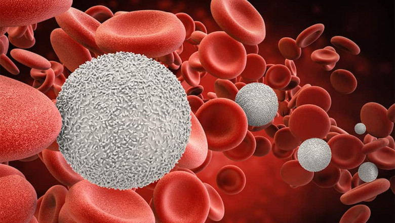 Recognizing Liver Cancer: Early Symptoms and Modern Treatment Approaches