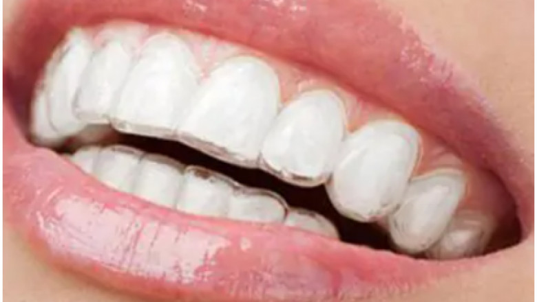 How Does London Road Dental Help Patients with the Required Relief?