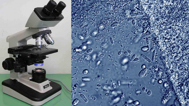 Microscopy Market: How Nanotechnology and AI are Transforming Microscopic Imaging and Analysis