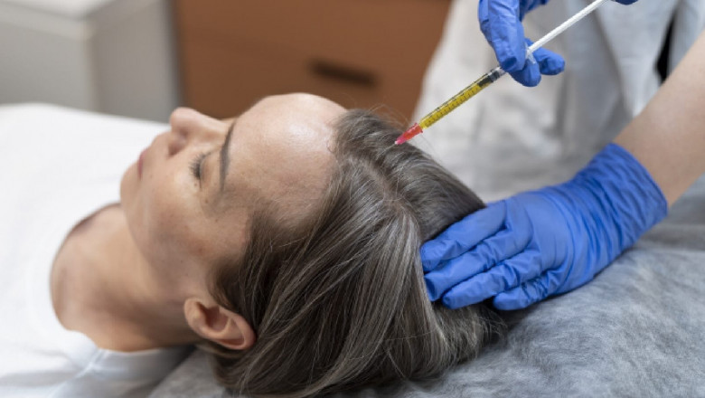 What Are the Signs of Early Hair Loss?