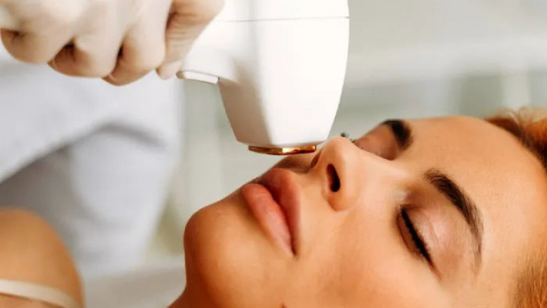 How Hormones Affect Laser Hair Removal Results