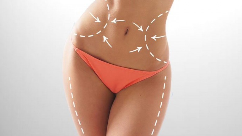Laser Liposuction in Dubai for Firmer, Tighter Skin