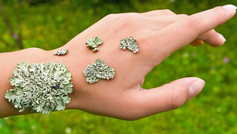 Lichen Planus Market to Surge Owing to Rising Prevalence