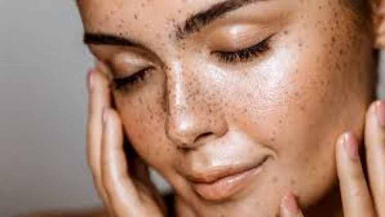 Downtime After Microneedling: Realistic Recovery Timeline
