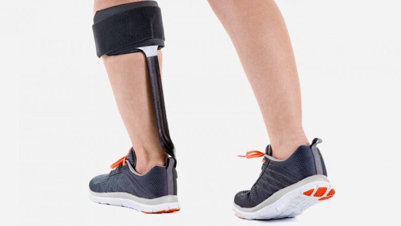 Foot Drop Treatment Devices Market to Surge Owing to Neurostimulation Innovations