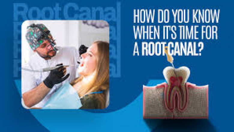 Signs You Need a Root Canal: How to Know When It’s Time for Treatment