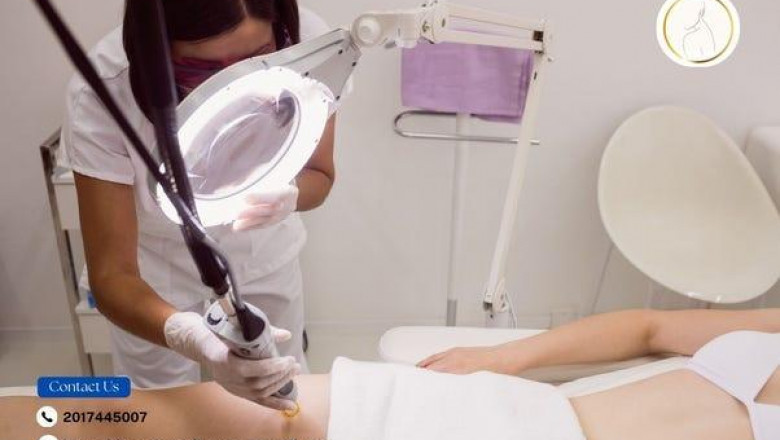 Unlock Healthy Skin: How Laser Therapy Reduces Stretch Marks and Restores Belief