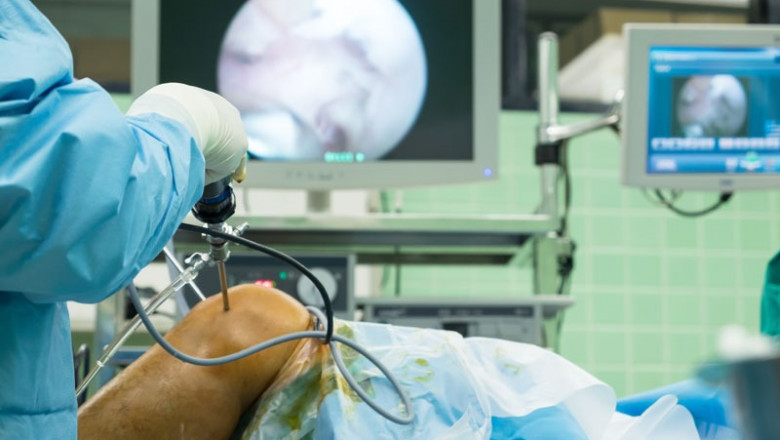 Arthroscopy Surgery Delhi: Advanced Joint Care Made Easy