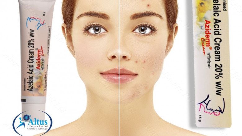 Aziderm 20 Cream The Ultimate Solution for Beautiful Skin!