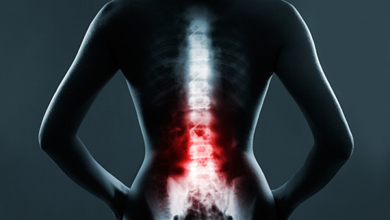 Comprehensive Therapies For Fertility And Lower Back Pain