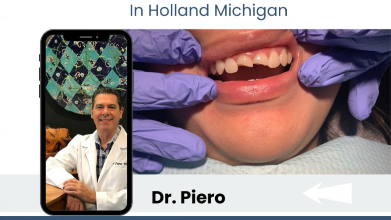 Dentist Accepting New Patients in Holland Michigan Now