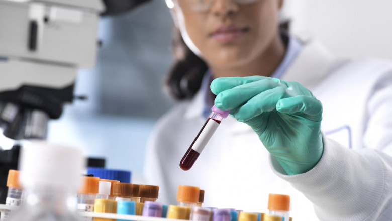 Homebound? Blood Test at Home in Dubai Is the Answer
