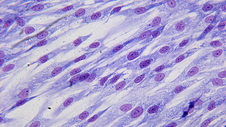 Human Osteoblasts Market to Grow Rapidly Owing to Regenerative Therapies