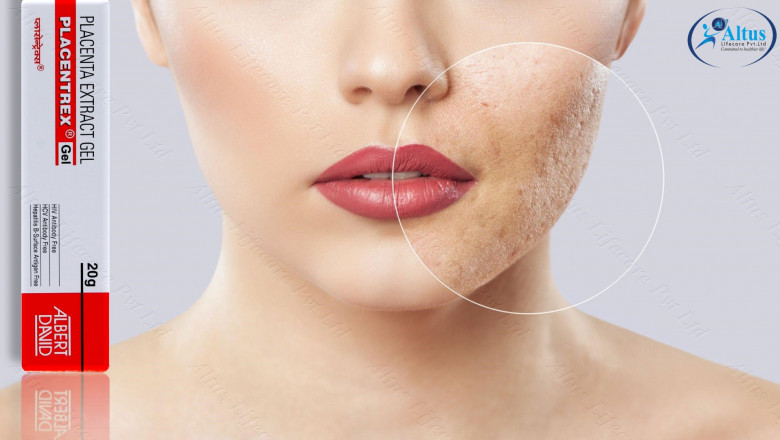 Placenta Extract Gel Unleashed The #1 Beauty Product Trend of 2025