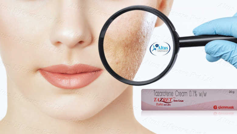 Say Goodbye to Wrinkles with Tazarotene Cream – Real Results Unveiled!
