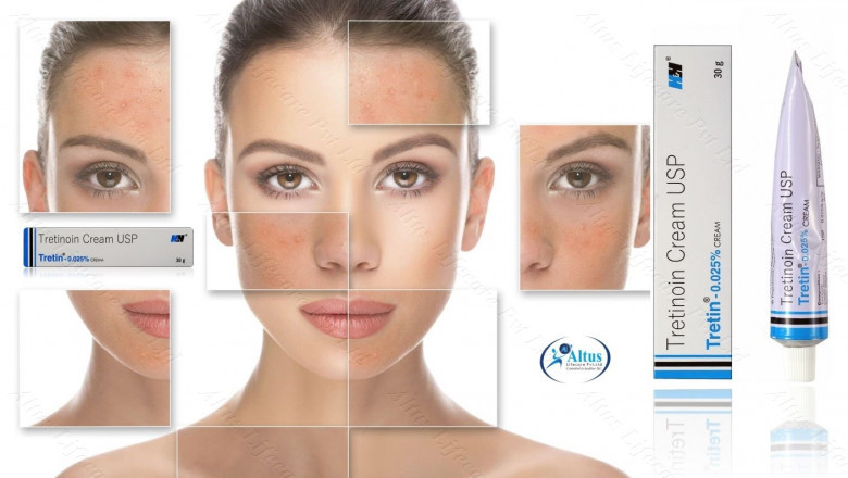 Tretin 0.05 Cream Review Is This the Ultimate Beauty Game-Changer