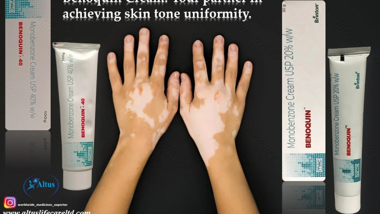 Vitiligo Vanished? See How 60 Monobenzone Cream Changed Her Skin Forever!