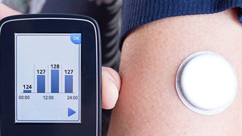 US Continuous Glucose Monitoring Market to Grow Fast Owing to Sensor Advances