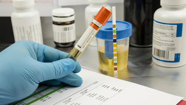 An Overview of Drug Screening for Students and Employees
