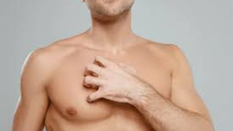 Can You Have Gynecomastia Surgery If You’ve Had Weight Loss?