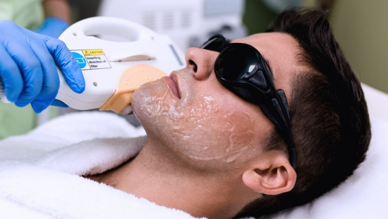 Is Laser Hair Removal Ideal for Individuals with Fine Hair?