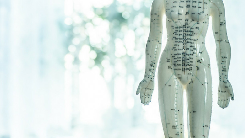 TCM and Acupuncture | What Is Acupuncture - Viva Healthy Life