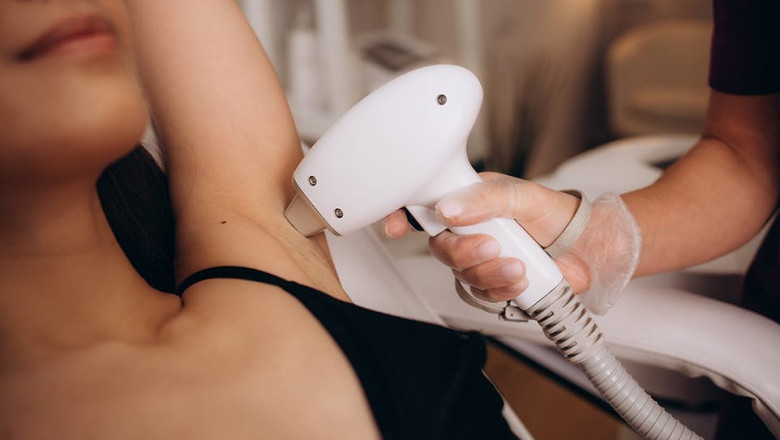Is Laser Hair Removal Worth It for Long-Term Results?