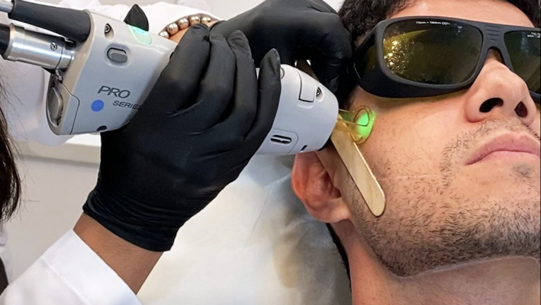 How to Know If Laser Hair Removal is Worth the Cost for Men in Dubai