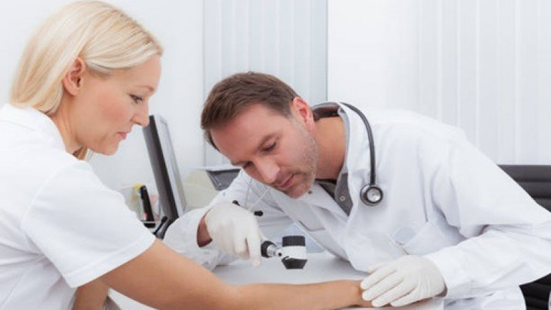 How to Remove Skin Tags on Eyelids Safely and Effectively