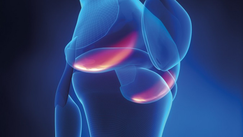 Knee Osteoarthritis Market to Surge Owing to Rising Demand for Regenerative Therapies