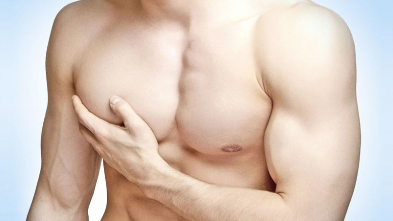 Restore a Masculine Chest with Advanced Gynecomastia Surgery in Delhi
