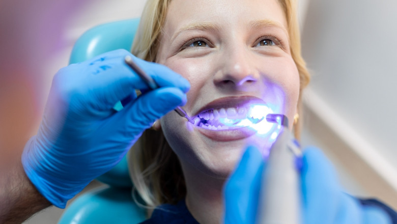 The Secret Reason Teeth Whitening Prices Vary So Drastically