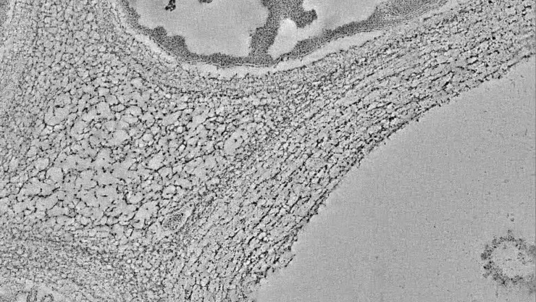 Cryo-Electron Microscopy: A Powerful Tool for Visualizing the Structure of Macromolecules