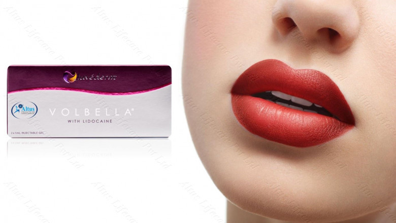 Discover the Beauty of Juvederm Volbella XC Unveil Radiant Lips and Soften Fine Lines for a Stunning Transformation!