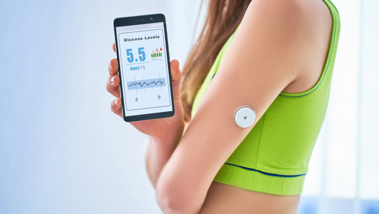 Continuous Glucose Monitoring (CGM) Market Dynamics: Key Trends, Growth Drivers, Challenges, and Future Outlook