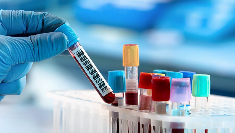 Cord Blood Banking Services Market Forecast: Trends, Growth Drivers, and Regional Outlook (2025–2034)
