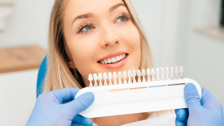 Improve Smile Proportions with Dental Veneers