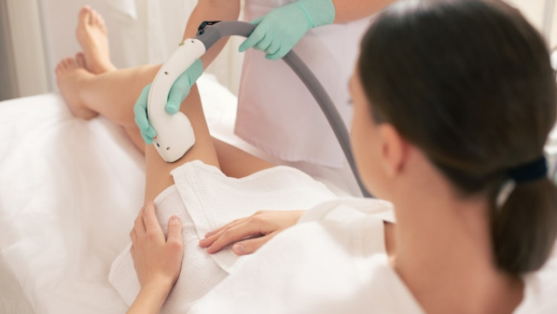 Laser Hair Removal for Legs: Smooth Skin Ahead