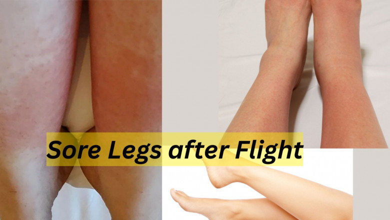 Sore Legs after Flight: What You Need to Know