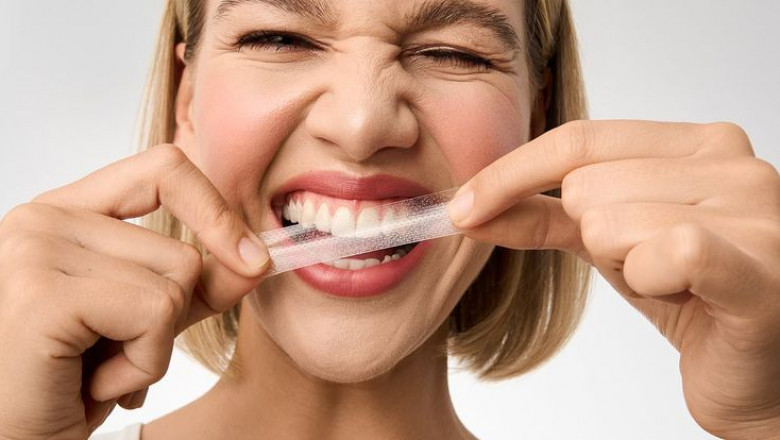 Do Whitening Strips Damage Teeth? Insights from WhiteStar Dental Clinic