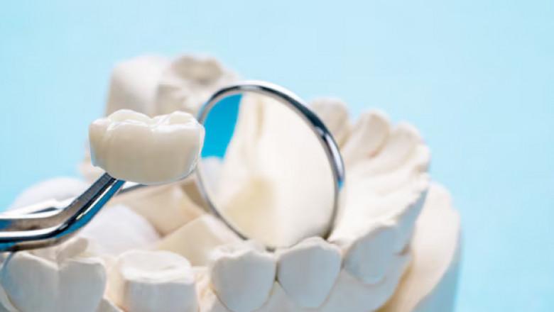 Porcelain Crowns: Way to Improve the Functionality of a Damaged Tooth