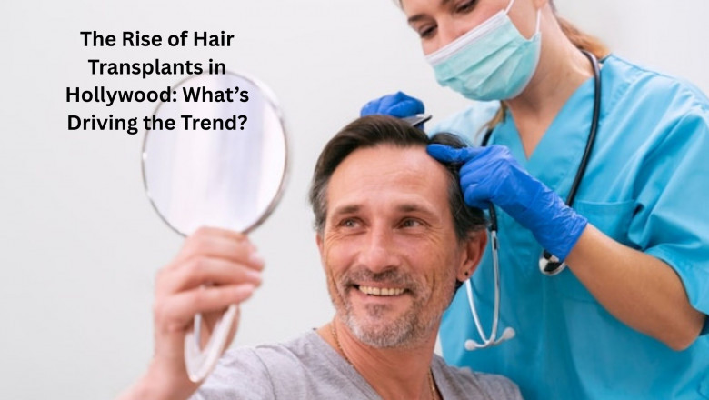 The Rise of Hair Transplants in Hollywood: What’s Driving the Trend?