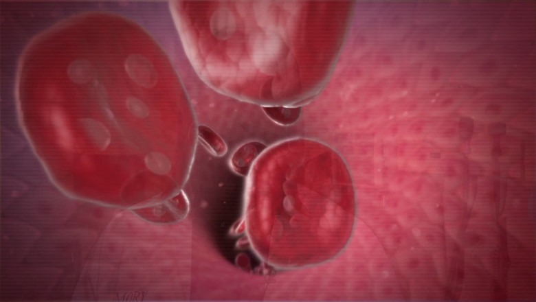 Warm Autoimmune Hemolytic Anemia Market to Soar with Biologic Innovations