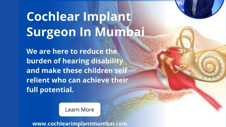 Cochlear Implant Surgery in India: Who Needs It, Benefits & Recovery Time Explained