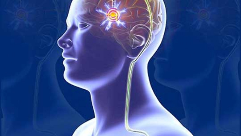 Dual Channel Deep Brain Stimulation (DBS) Devices Market Growth Exponential To 2033