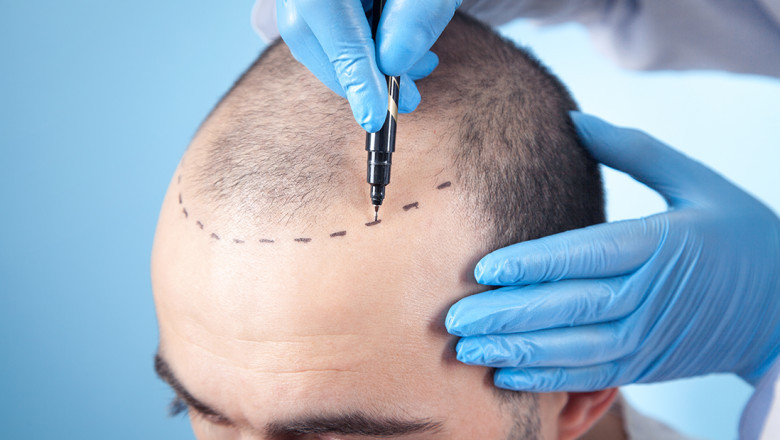 Proven Hair Care Routines Recommended by a Hair Specialist Doctor
