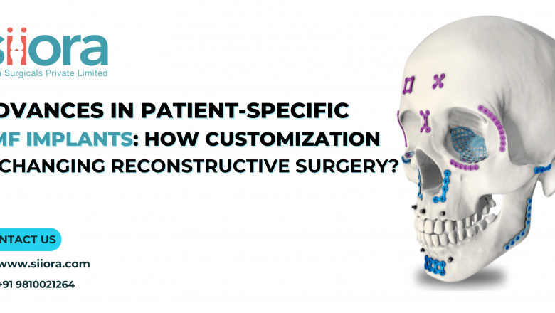 Advances in Patient-Specific CMF Implants: How Customization Is Changing Reconstructive Surgery?