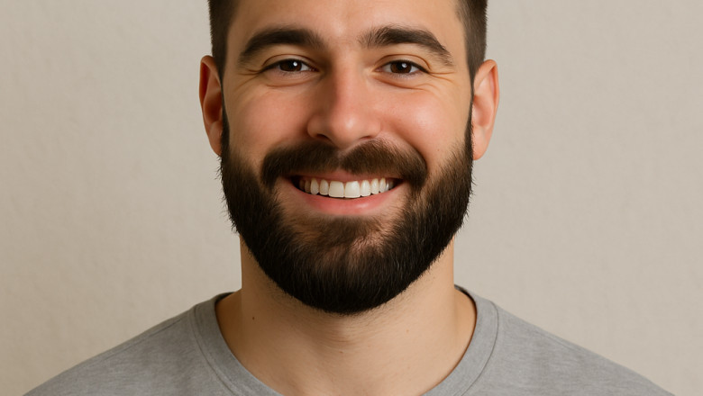 Afro Hair Transplant for Men: What You Need to Know