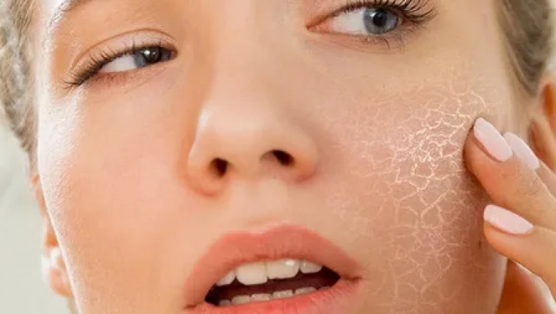 Dehydrated Skin Product Market Projections Indicate Growth in Asia-Pacific and North American Regions