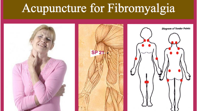 Fibromyalgia: Causes, Symptoms, Western and Holistic Treaments